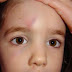 Παιδί: Τραυματισμός στο κεφάλι