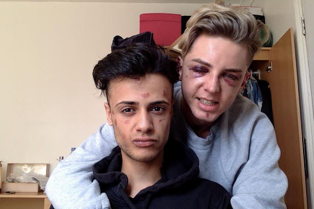 Tribunal do Reino Unido aumenta pena de homofóbicos por considerar "indevidamente suave" 2 Ataque%2Bhomof%25C3%25B3bico%2B %2BReino%2BUnido1