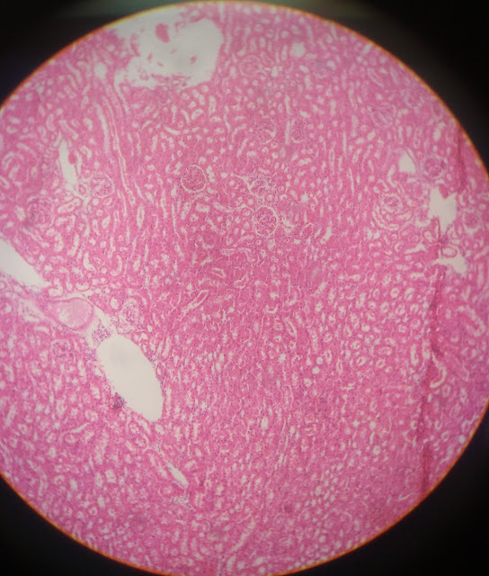 histology slide of glomerulus of kidney