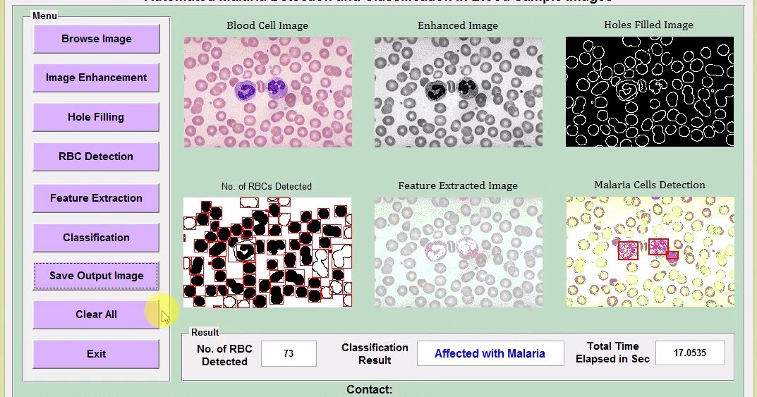 Malaria Detection in Blood Cell Images Using Image Processing Matlab ...