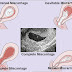 What causes miscarriages?