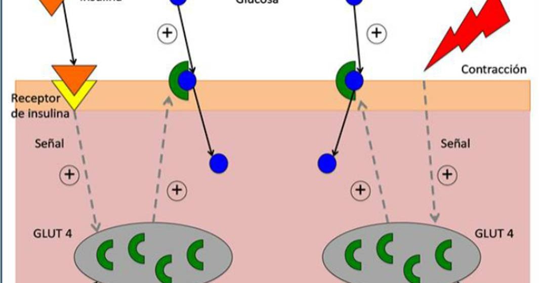 Ciencia e Imaginación Diabetes tipo II y ejercicio