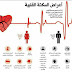 اعراض السكتة او الصدمة القلبية Heart Shock