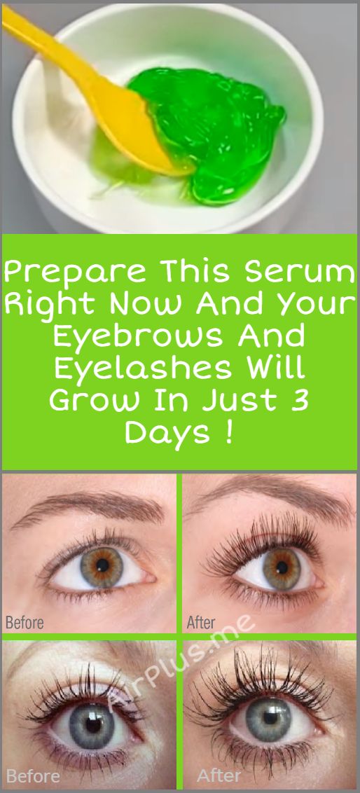 Prepare This Serum Right Now And Your Eyebrows And Eyelashes Will Grow