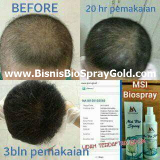 Testimoni MSI Bio Spray - Multy Spray Testimoni MSI Bio Spray, Testimoni MSI Multy Spray