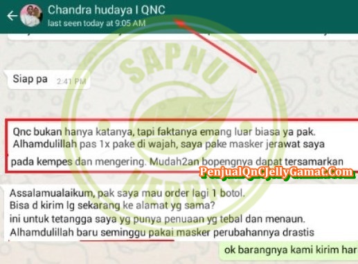 Cara Menghilangkan Jerawat di Kulit Kepala Secara Alami Sampai Tuntas Cara Menghilangkan Jerawat di Kulit Kepala Secara Alami Sampai Tuntas