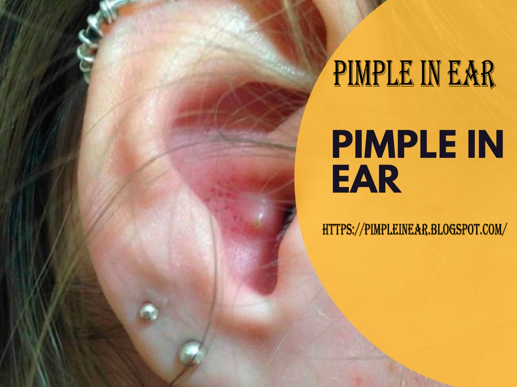 Lump Behind Ear Pictures Cyst Behind Ear Causes Treat