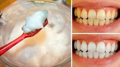 Brush Your Teeth With This Mixture And Say Goodbye To Tartar And Caries Forever Brush Your Teeth With This Mixture And Say Goodbye To Tartar And Caries Forever