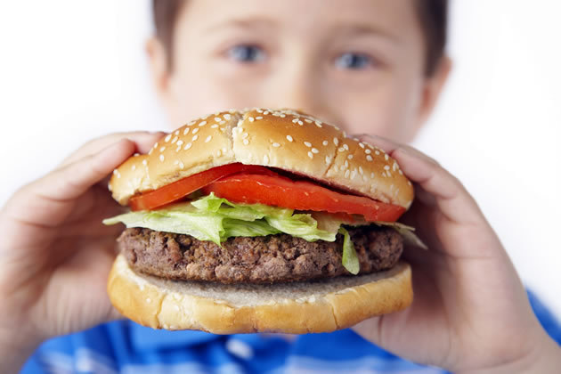Obesidade Infantil Obesidade Infantil