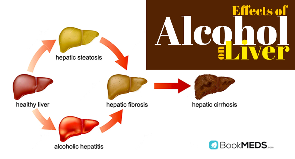 Don't Wreck Your Liver!