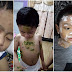 Petua Mudah Bagaimana Untuk Buatkan Chickenpox Yang Menjangkiti Anak Kita Cepat Kering