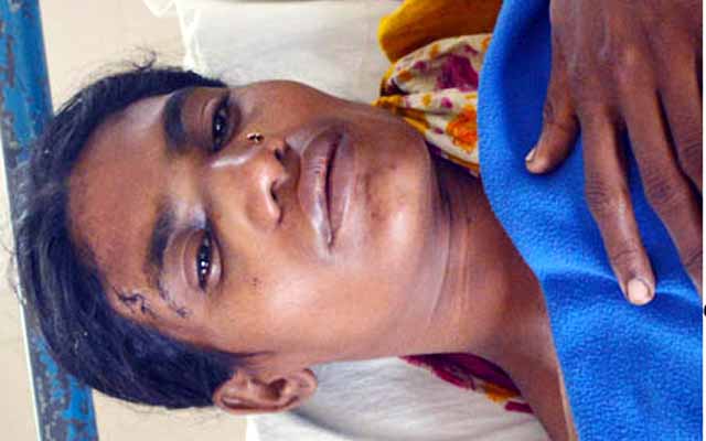 Babitake beaten injured ববিতাকে পিটিয়ে জখম