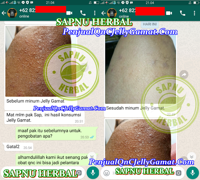 Obat Jamur di Kulit Kepala di Apotik Paling Manjur & Alami utk Semua Usia Obat Jamur di Kulit Kepala di Apotik Paling Manjur & Alami utk Semua Usia