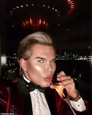 Human Ken Doll Rodrigo Alves Speaks On The Horror Of Having His Drink