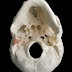 Petrotympanic fissure - Pictures, Skull, Chorda tympani, Petrosquamous fissure