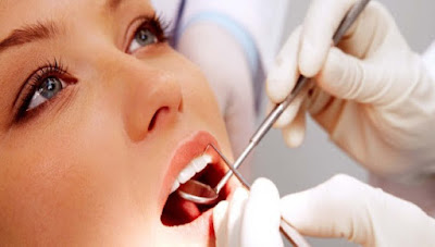 Răng hàm số 6 bị sâu có nguy hiểm không? Nhung-bien-chung-co-the-gap-khi-cay-implant