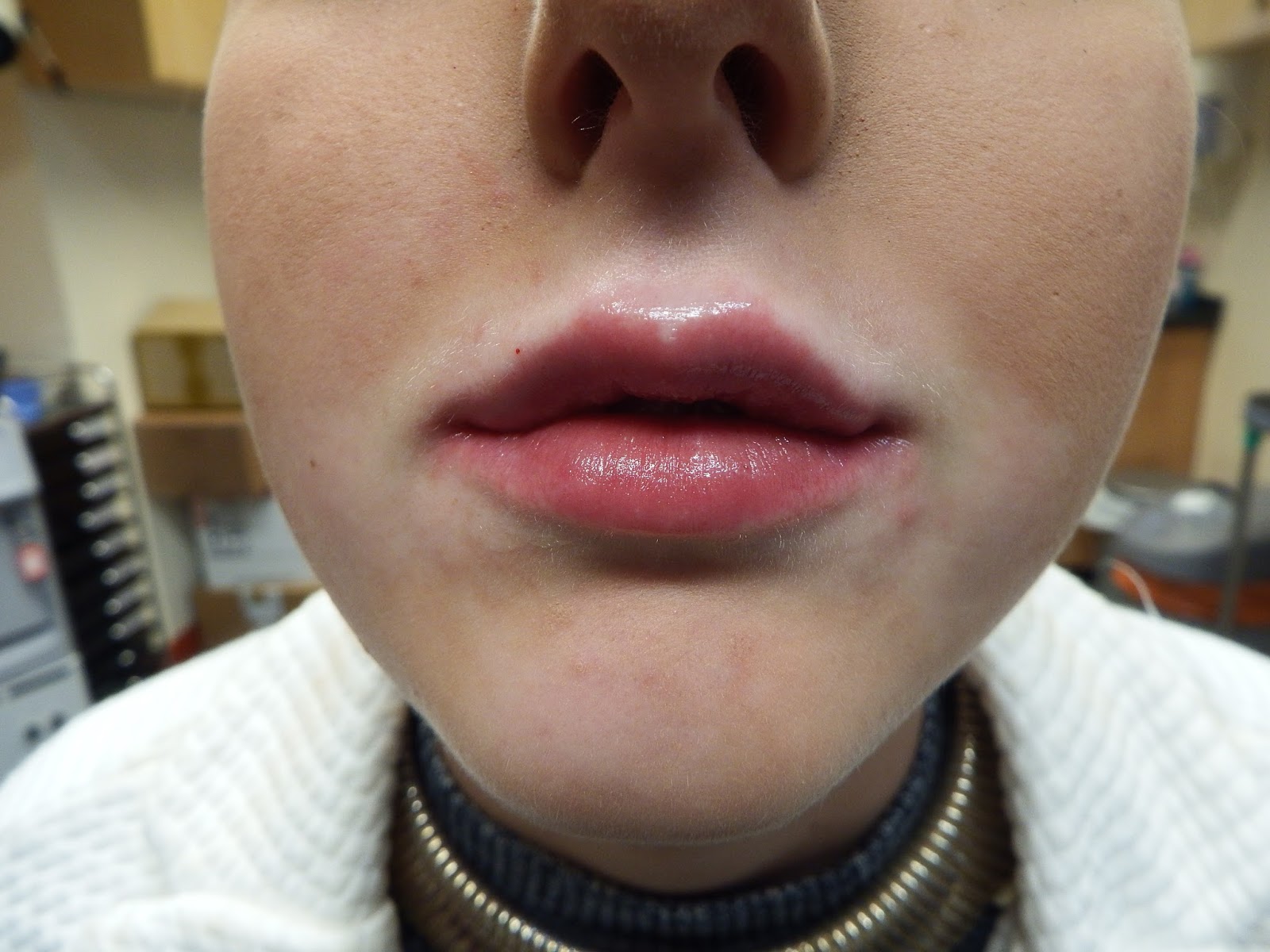 Selston Cosmetic Clinic: Botox - Vaser Lipo - Lip Enhancement - Laser