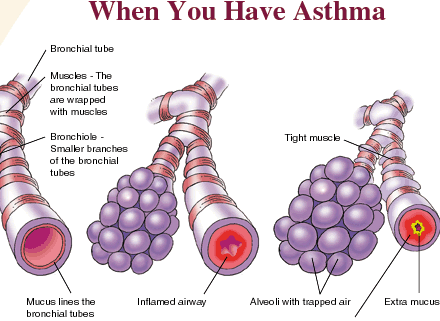 what does advair do for the lungs