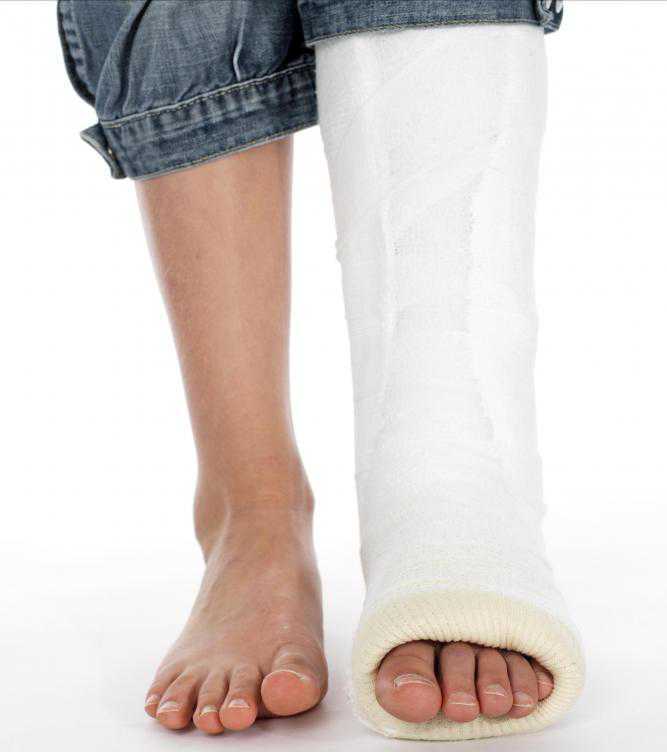 Seputar Patah Tulang / Fracture Sahabat Informasi