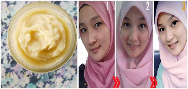 Gak Perlu Pake Masker Mahal, Cukup Pake Masker Buatan Sendiri Aja Wajah Bisa Bersih Mulus dan Berkilau dalam 2 Minggu !! Gak Perlu Pake Masker Mahal, Cukup Pake Masker Buatan Sendiri Aja Wajah Bisa Bersih Mulus dan Berkilau dalam 2 Minggu !!