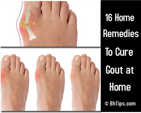 Natural Diuretic Treatment Natural Diuretic Treatment