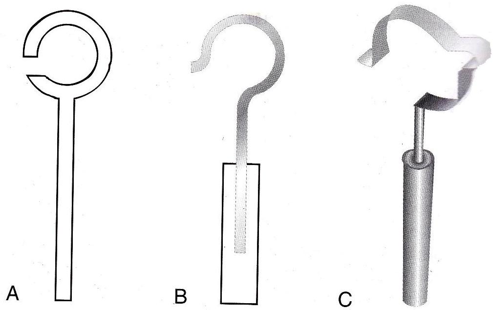 MBBS DOCTORS OTOSCLEROSIS