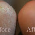 HOW TO CLEAN THE FEET ??? IT’S VERY EASY TRY THIS AND THE RESULTS ARE INCREDIBLE!!!