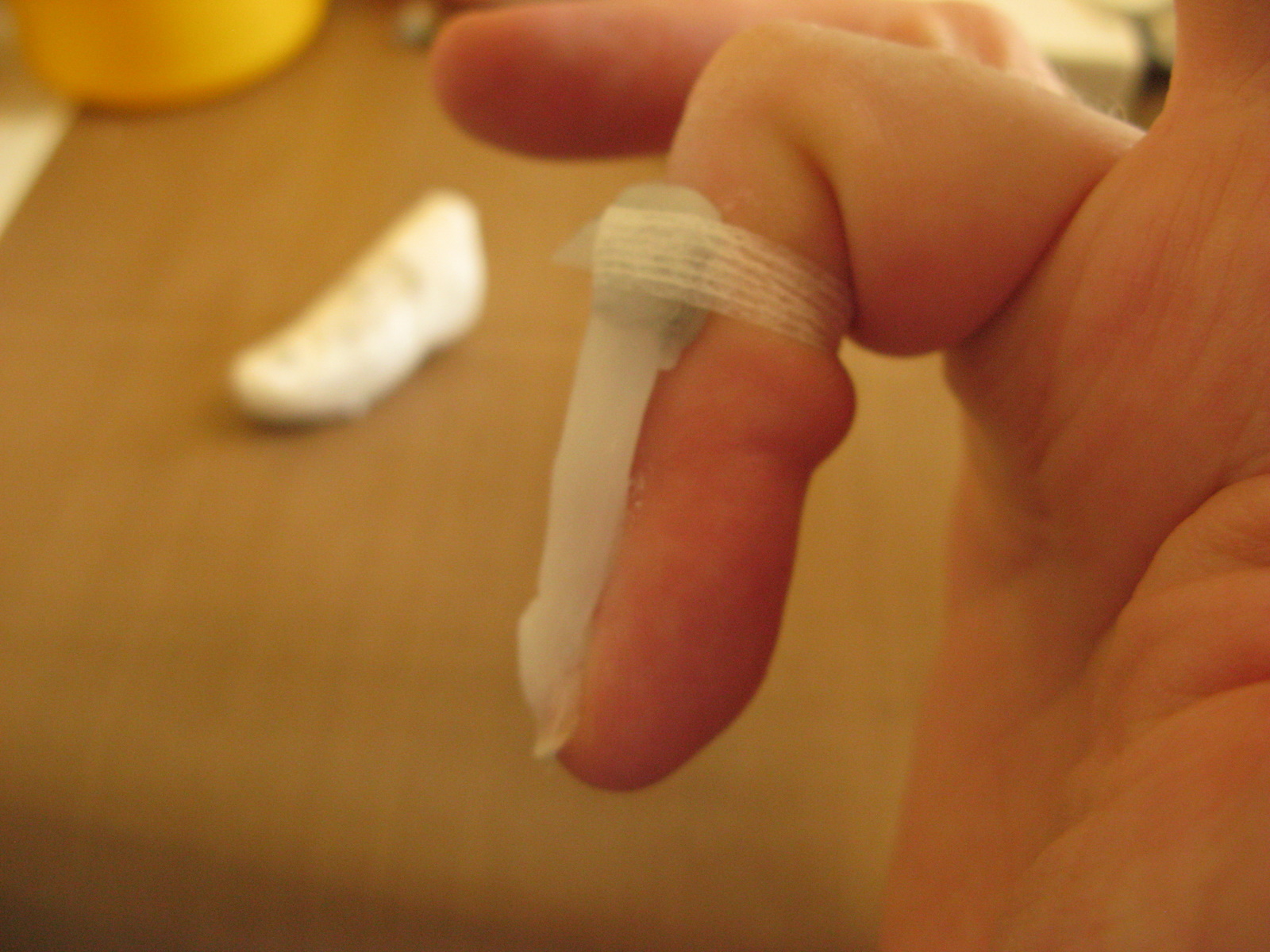 v12 and finger casts 53 days