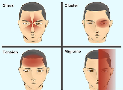 10 Helpful Remedies To Relieve Headache Pain And Tension 10 Helpful Remedies To Relieve Headache Pain And Tension