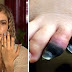 Woman Loses Multiple Fingers & Toes After Getting This Common Illness
