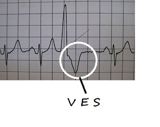 VES12.jpg