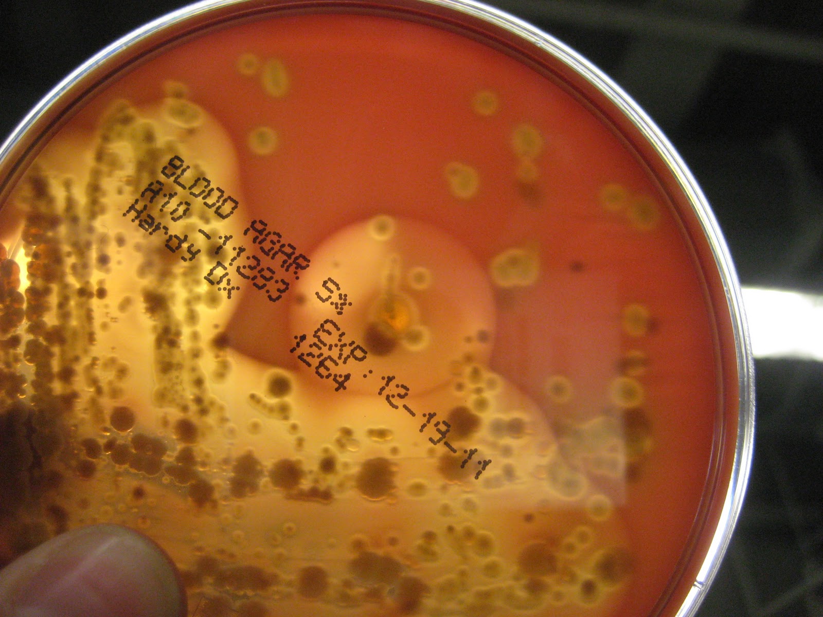 DVC Microbiology 146 Fall 11 (Gard): Lab 34: Throat Culture