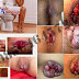 Jual Antihemoroid AmbeJOSS Obati Wasir thumbnail