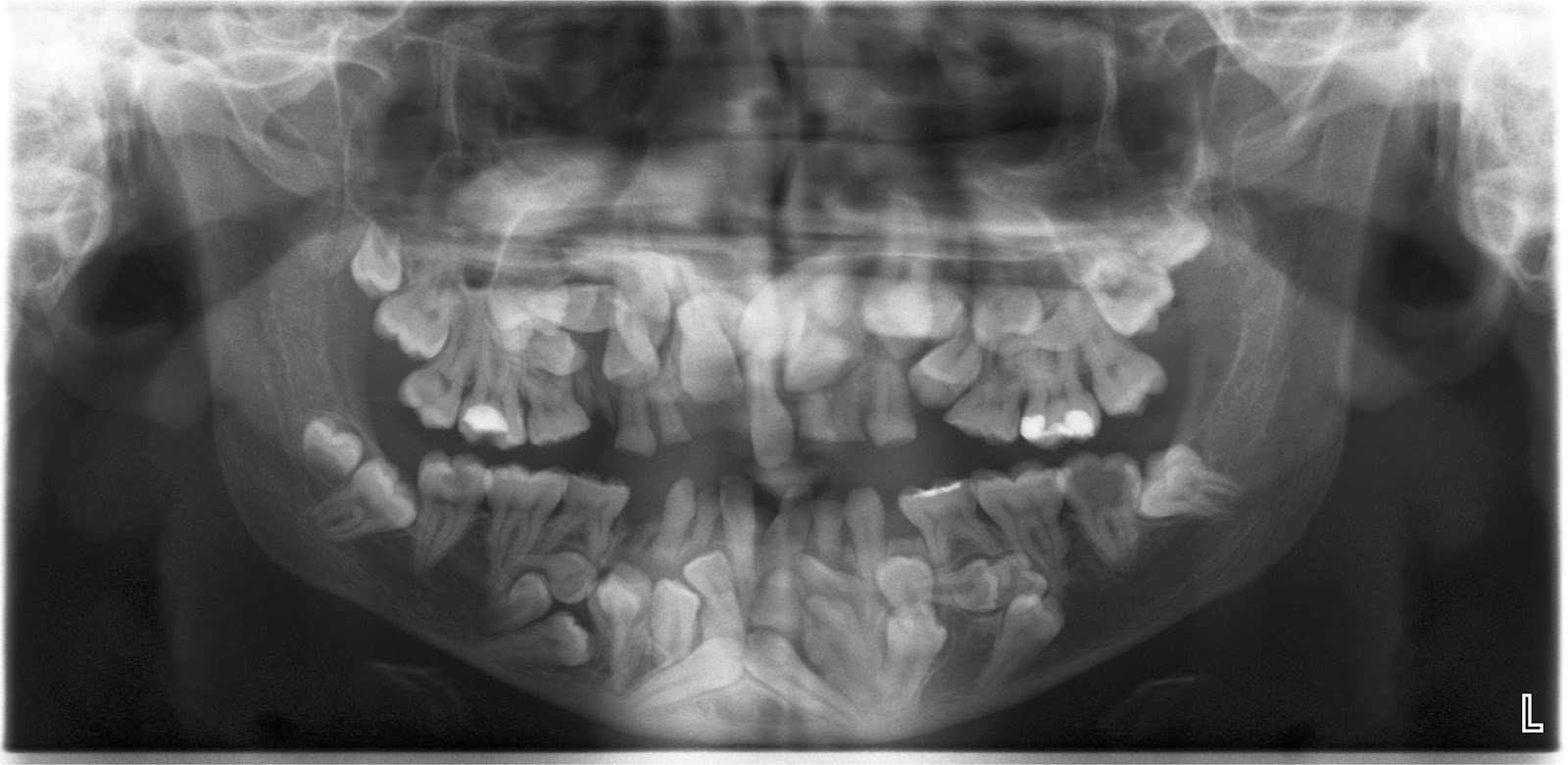StuDENT Diaries U.S Army Dental Corps