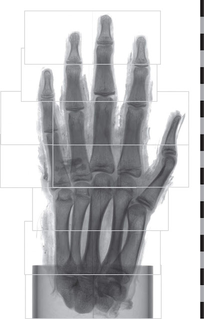 CT technique expands possibilities of imaging ancient remains CT technique expands possibilities of imaging ancient remains