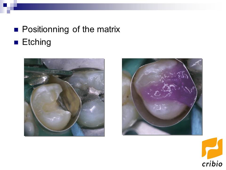 Dentistry Dental resin composites