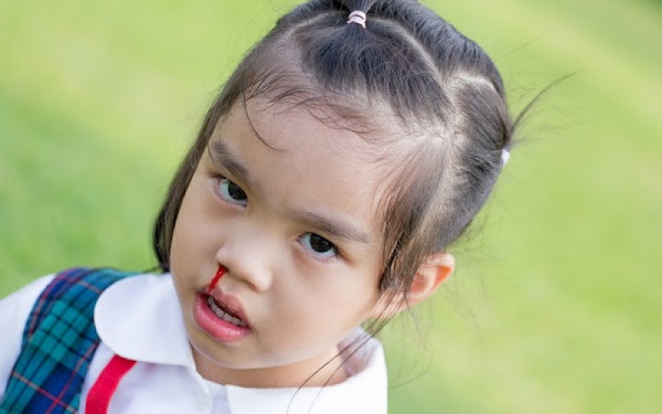 Penyebab Mimisan pada Anak saat Tidur secara Tiba Tiba Penyebab Mimisan pada Anak saat Tidur secara Tiba Tiba