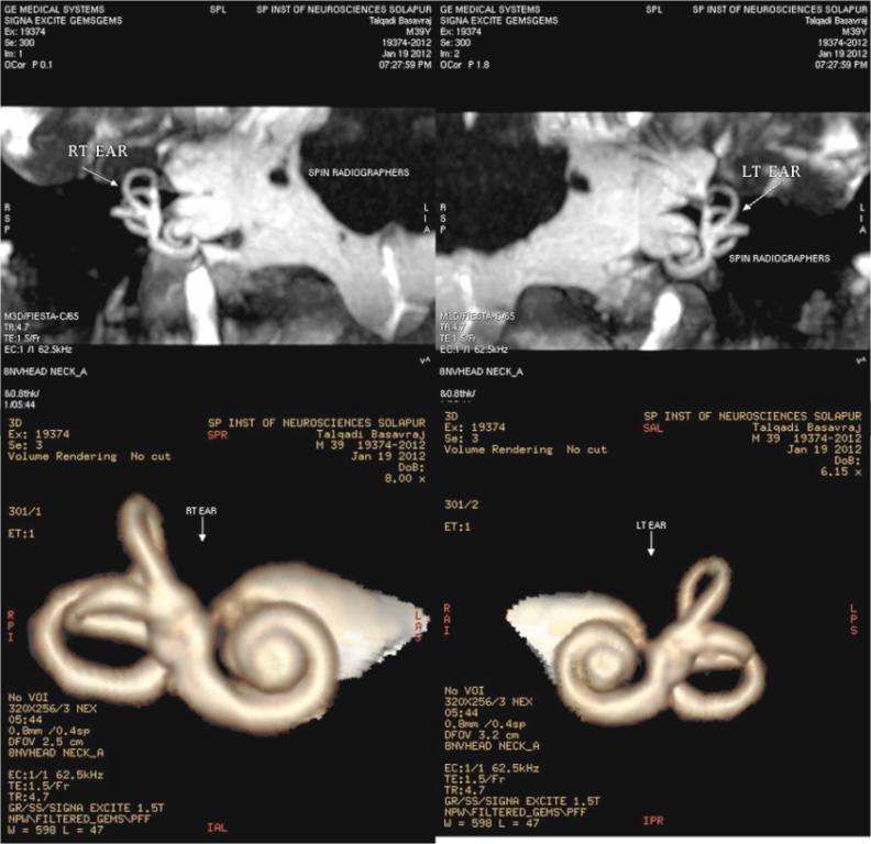 MRI Protocols FIESTA pulse sequence MRI