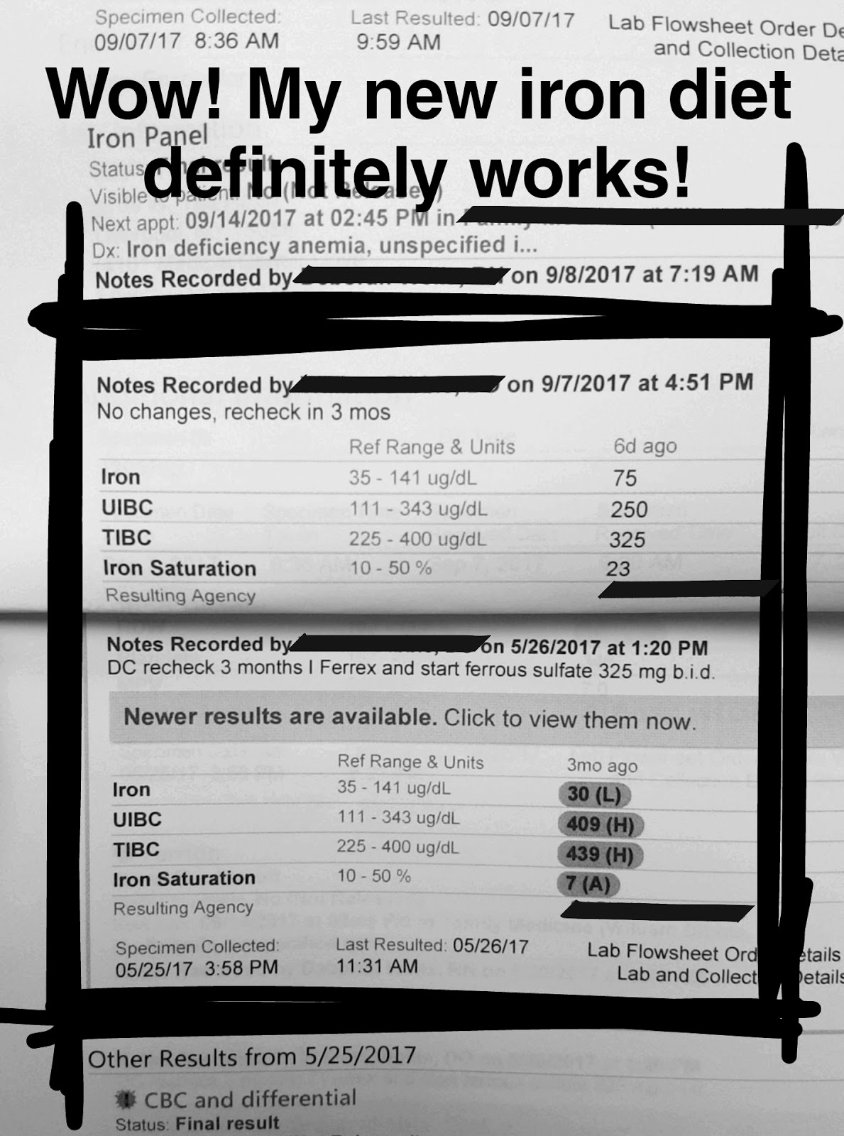 Solving Iron Deficiency Anemia A Snapshot