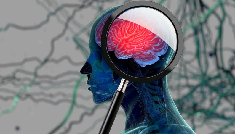 Lúpus e saúde mental: um novo estudo descobre que a doença duplica o risco de demência, independentemente da idade Lúpus e saúde mental: um novo estudo descobre que a doença duplica o risco de demência, independentemente da idade