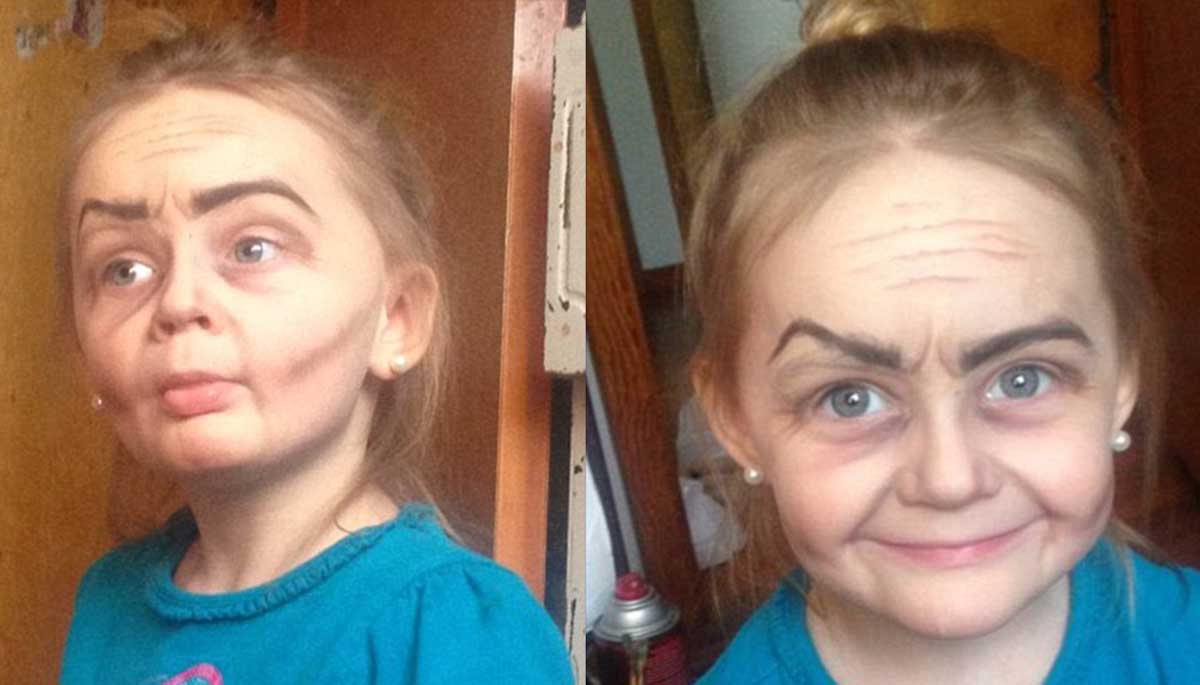 прогерия лена мельникова. девочка лицом бабушки. девочка лицом бабушки. прогерия катя неженцева. девочка с лицом бабушки.