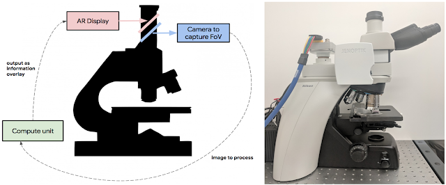 An Augmented Reality Microscope for Cancer Detection