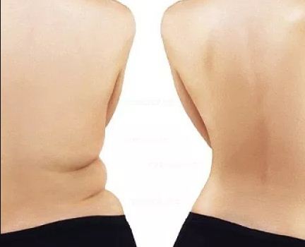 This Simple Exercise Helps Remove Back and Belly Fat In No Time!