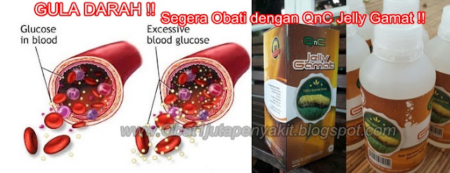 Obat Gula Darah Herbal, 100% Terbukti MANJUR Mengobati Penyakit Gula Darah Obat Gula Darah Herbal, 100% Terbukti MANJUR Mengobati Penyakit Gula Darah