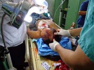 Un hombre celoso da machetazos a otro por el amor de una mujer