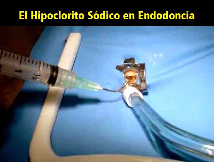 Para que sirve el hipoclorito de sodio