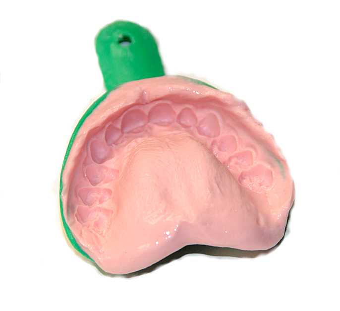 Daily Dentist What's that Word? Dental Jargon from A to Z I is for