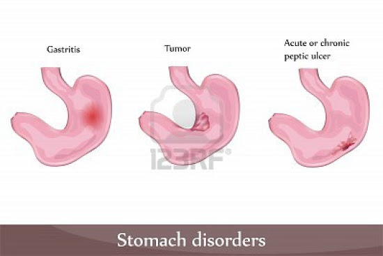 Que significa soñar con gastritis