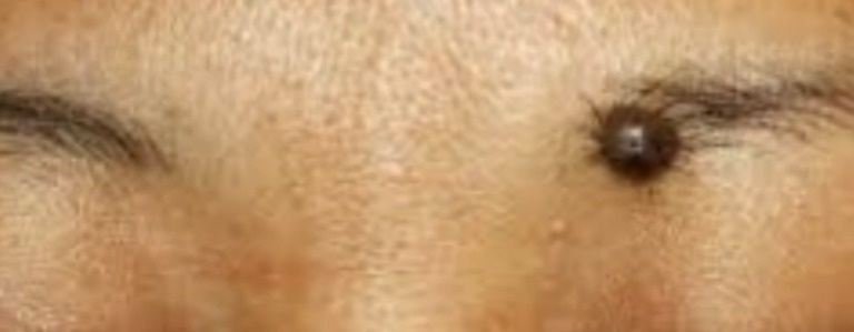 #10. This also means you love being around people and thrive in group settings. - These Moles On Your Body May Reveal Secrets About Your Life. #10. This also means you love being around people and thrive in group settings. - These Moles On Your Body May Reveal Secrets About Your Life.