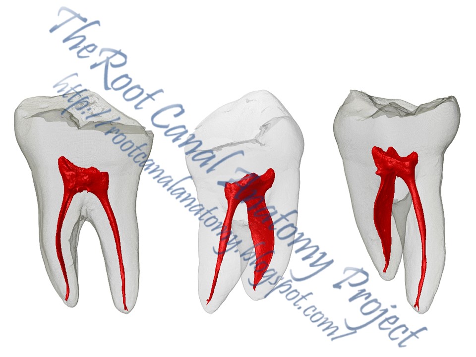 The Root Canal Anatomy Project